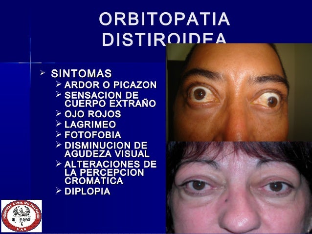 hipertensión pulmonar pdf - Información general Un