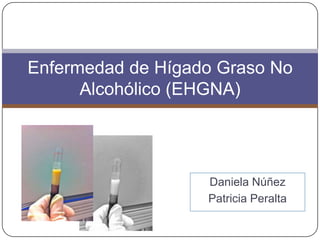 Enfermedad de Hígado Graso No
Alcohólico (EHGNA)

Daniela Núñez
Patricia Peralta

 