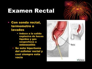 Examen Rectal
• Con sonda rectal,
  termometro o
  lavados
     • Induce a la salida
       explosiva de heces
       liquidas y gas
       sospechoso a
       enterocolitis
  • Se nota hipertonía
    del esfínter rectal y
    casi siempre esta
    vacío
 