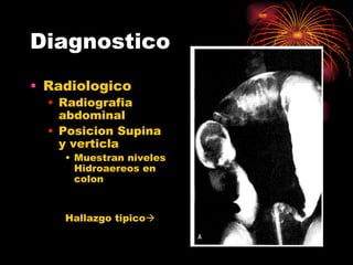 Diagnostico
• Radiologico
  • Radiografia
    abdominal
  • Posicion Supina
    y verticla
    • Muestran niveles
      Hidroaereos en
      colon


    Hallazgo tipico
 