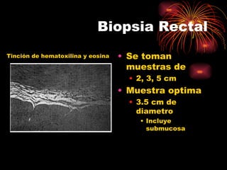 Biopsia Rectal
Tinción de hematoxilina y eosina   • Se toman
                                     muestras de
                                     • 2, 3, 5 cm
                                   • Muestra optima
                                     • 3.5 cm de
                                       diametro
                                       • Incluye
                                         submucosa
 