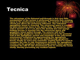 Tecnica
The advantage of the Duhamel pull-through is that very little
manipulation of the rectum is performed anteriorly thus avoiding
injury to the genitourinary innervation. The rectum is divided and
closed just above the peritoneal reflection. The redundant
aganglionic bowel is resected. The retrorectal space is created
by blunt dissection down to the pelvic floor. The posterior rectal
wall is incised 1.5 to 2 cm above the dentate line and sponge
holding forceps is inserted into the retrorectal space and
ganglionic bowel pulled through. The anterior half of the
pulledthrough ganglionic bowel is anastomosed to the posterior
wall of the aganglionic rectum and remainder of the colo-rectal
anastomosis completed by approximating the aganglionic
rectum to the posterior wall of the pulled-through ganglionic
bowel. Finally an extra long automatic stapling device is used to
complete the side to side anastomosis between the aganglionic
rectum and the ganglionic pulled-through bowel. Some surgeons
complete the side to side anastomosis prior to closing the rectal
stump, thereby preventing any residual septum.
 