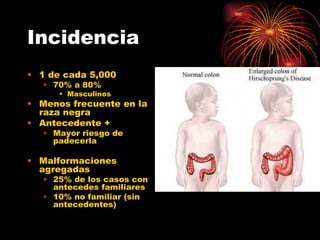 Incidencia
• 1 de cada 5,000
   • 70% a 80%
      • Masculinos
• Menos frecuente en la
  raza negra
• Antecedente +
   • Mayor riesgo de
     padecerla

• Malformaciones
  agregadas
   • 25% de los casos con
     antecedes familiares
   • 10% no familiar (sin
     antecedentes)
 
