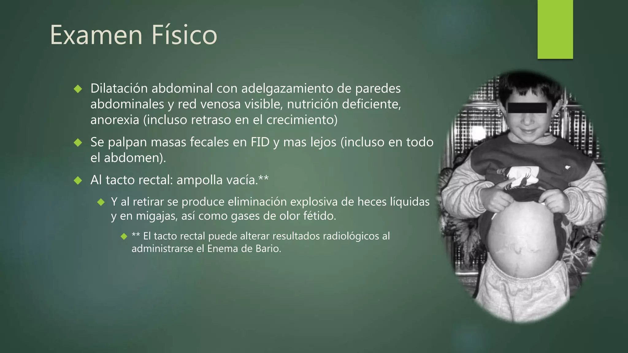 Enfermedad de hirschsprung PPT