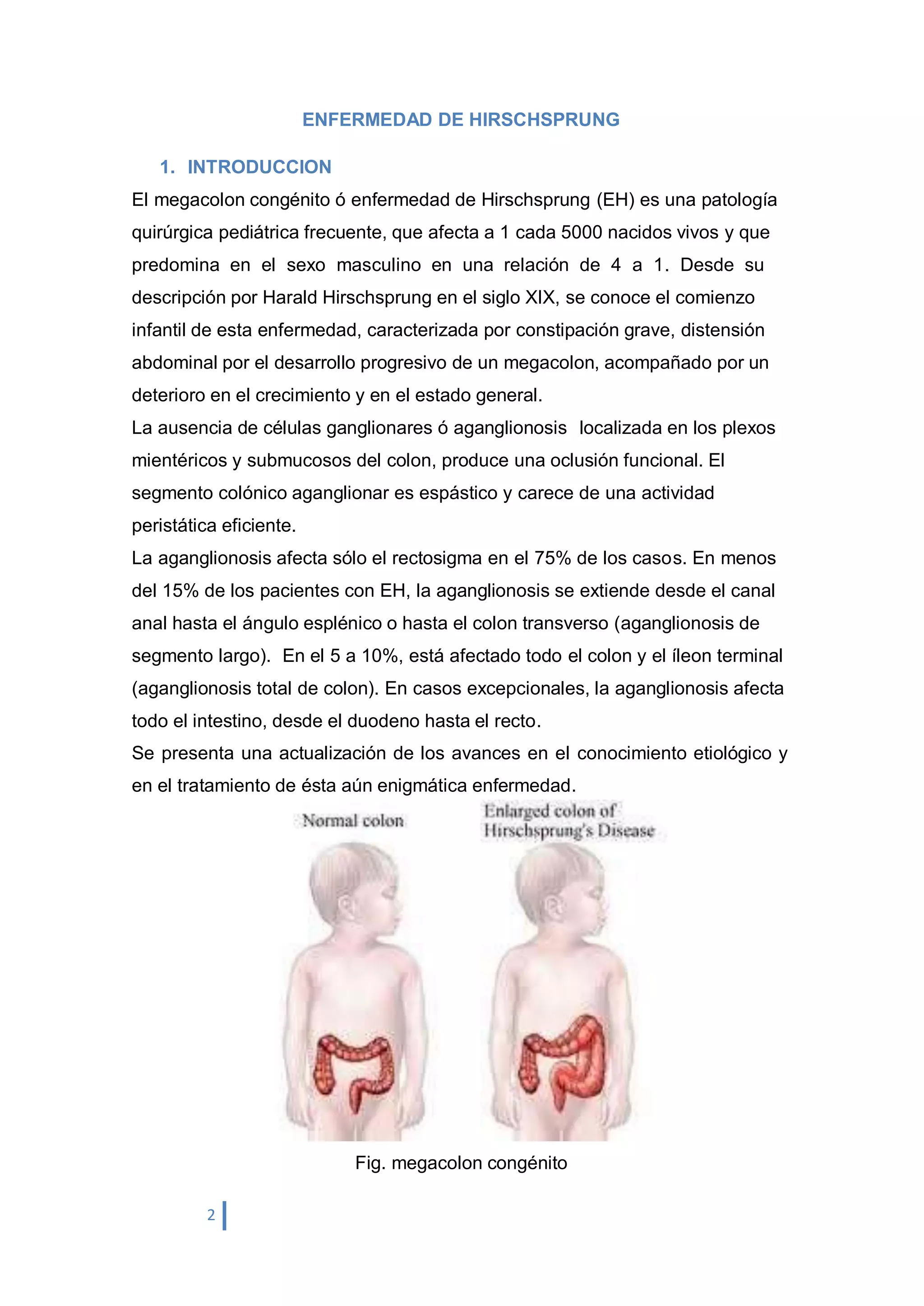 Enfermedad de hirschsprung - Malformaciones Anorectales | PPTX