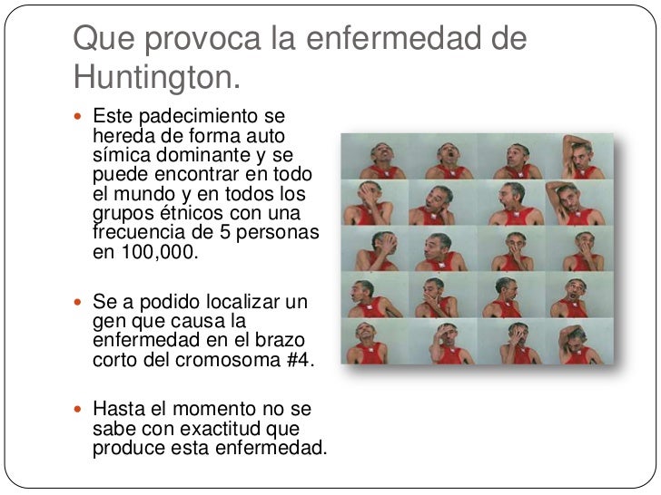 Enfermedad de huntington Enfermedad de huntington