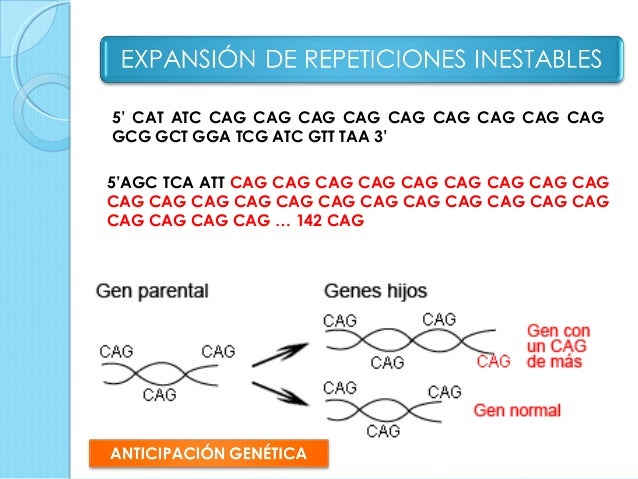 Enfermedad de huntington Enfermedad de huntington