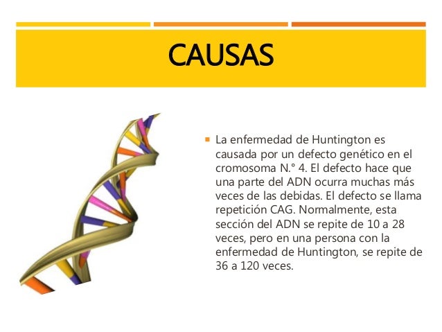 Enfermedad de huntington Enfermedad de huntington