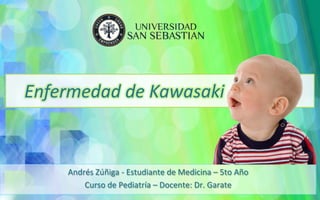 Enfermedad	
  de	
  Kawasaki	
  
Andrés	
  Zúñiga	
  -­‐	
  Estudiante	
  de	
  Medicina	
  –	
  5to	
  Año	
  
Curso	
  de	
  Pediatría	
  –	
  Docente:	
  Dr.	
  Garate	
  
 