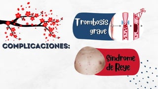Complicaciones:
Complicaciones:
Trombosis
Trombosis
grave
grave
Síndrome
Síndrome
de Reye
de Reye
 