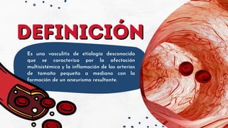 DEFINICIÓN
DEFINICIÓN
Es una vasculitis de etiología desconocida
que se caracteriza por la afectación
multisistémica y la inflamación de las arterias
de tamaño pequeño a mediano con la
formación de un aneurisma resultante.
 