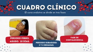 CUADRO CLÍNICO
CUADRO CLÍNICO
El curso evolutivo se divide en tres fases
Periodo febril
agudo: 10 días.
Periodo subagudo:
2 y 4 semanas.
Fase de
convalecencia
 