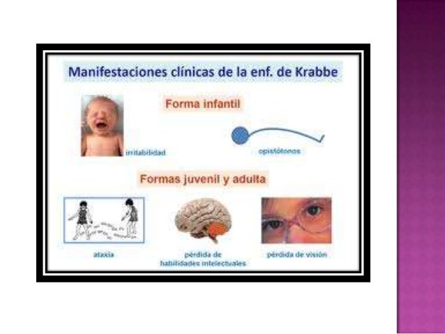Enfermedad de krabbe