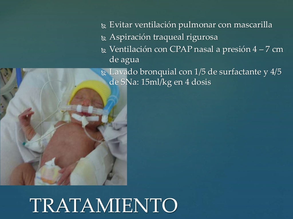 Enfermedad de la membrana hialina Enfermedad de la membrana hialina