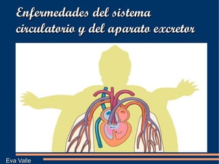 Enfermedades del sistema circulatorio y del aparato excretor Eva Valle  