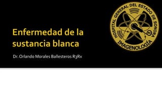 Dr. Orlando Morales Ballesteros R3Rx

 