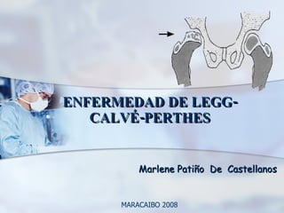 ENFERMEDAD DE LEGG-CALVÉ-PERTHES Marlene Patiño  De  Castellanos MARACAIBO 2008 
