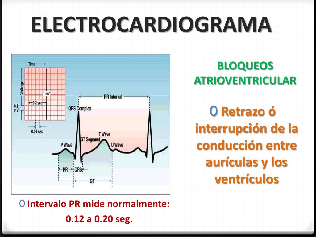 Enfermedad del nodo sinusal Enfermedad del nodo sinusal