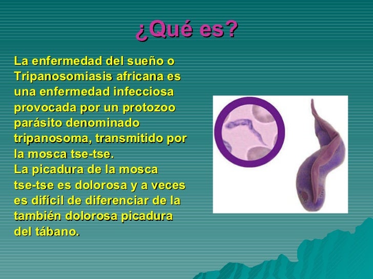 Enfermedad del sueño