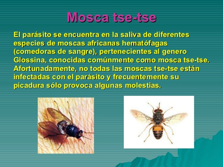 Enfermedad del sueño