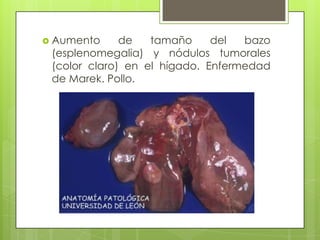Aumento de tamaño del bazo (esplenomegalia) y nódulos tumorales (color claro) en el hígado. Enfermedad de Marek. Pollo.