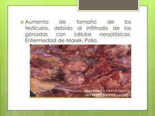 Aumento de tamaño de los testículos, debido al infiltrado de las gónadas con células neoplásicas. Enfermedad de Marek. Pollo.