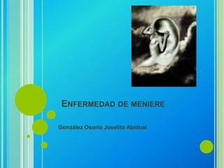 ENFERMEDAD DE MENIERE
González Osorio Joselito Abiduai
 