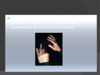  El temblor es muy importante, ya que se
presenta en 85% de los pacientes con
enfermedad de Parkinson verdadera.
 