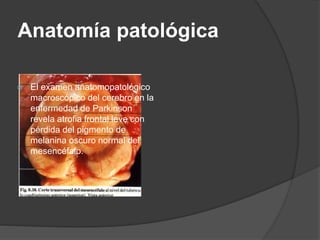 Anatomía patológica
 El examen anatomopatológico
macroscópico del cerebro en la
enfermedad de Parkinson
revela atrofia frontal leve con
pérdida del pigmento de
melanina oscuro normal del
mesencéfalo.
 