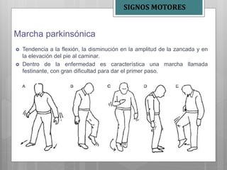 Marcha parkinsónica
 Tendencia a la flexión, la disminución en la amplitud de la zancada y en
la elevación del pie al caminar.
 Dentro de la enfermedad es característica una marcha llamada
festinante, con gran dificultad para dar el primer paso.
SIGNOS MOTORES
 