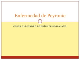 Enfermedad de Peyronie

CESAR ALEJANDRO RODRÍGUEZ SEGOVIANO
 