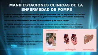 MANIFESTACIONES CLINICAS DE LA
ENFERMEDAD DE POMPE
Es una enfermedad neuromuscular que se presenta con un espectro variable de
edad de inicio, implicación orgánica y grado de miopatía (afectación muscular).
Se clasifica básicamente en las formas infantil y de inicio tardío.
LA FORMA INFANTIL.- se presenta antes del primer año de vida, edad media alrededor de los 2 meses.
Dentro de esta forma se distinguen los pacientes con forma infantil clásica, más grave, que se caracteriza
por:
• Cardiomegalia (aumento del tamaño cardíaco).
• Debilidad muscular generalizada.
• Hipotonía.
• Hepatomegalia (aumento del tamaño del hígado).
• Fallo respiratorio antes del año de vida.
 