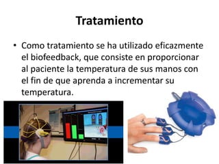 Tratamiento
• Como tratamiento se ha utilizado eficazmente
el biofeedback, que consiste en proporcionar
al paciente la temperatura de sus manos con
el fin de que aprenda a incrementar su
temperatura.
 