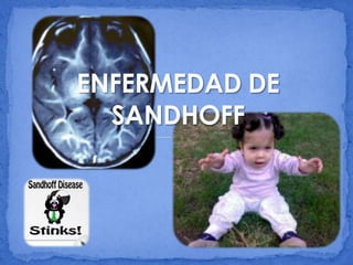 Enfermedad de sandhoff (1) | PPTX