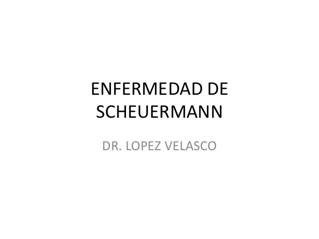 Enfermedad de scheuermann ESCOLIOSIS JUVENIL