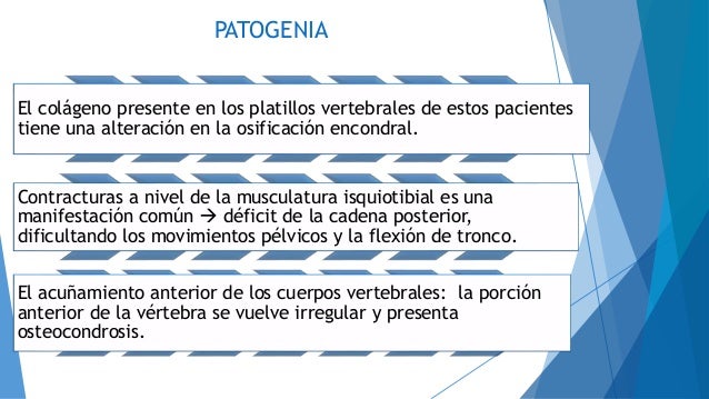 La manifestación inicial sheynogo de la osteocondrosis