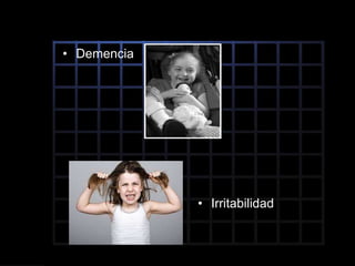 • Demencia
• Irritabilidad
 