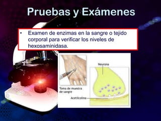 Pruebas y Exámenes
• Examen de enzimas en la sangre o tejido
corporal para verificar los niveles de
hexosaminidasa.
 