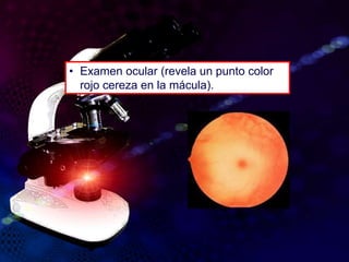 • Examen ocular (revela un punto color
rojo cereza en la mácula).
 