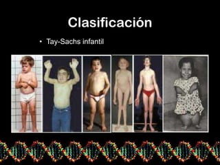 Clasificación
• Tay-Sachs infantil
 
