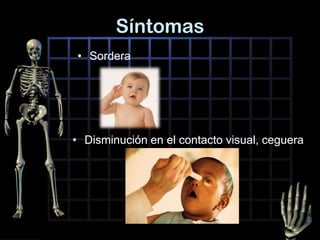 Síntomas
• Sordera
• Disminución en el contacto visual, ceguera
 