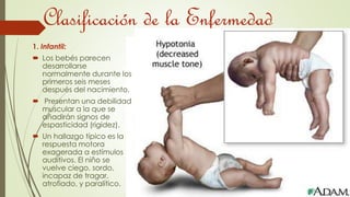 Clasificación de la Enfermedad 
1. Infantil: 
 Los bebés parecen 
desarrollarse 
normalmente durante los 
primeros seis meses 
después del nacimiento. 
 Presentan una debilidad 
muscular a la que se 
añadirán signos de 
espasticidad (rigidez). 
 Un hallazgo típico es la 
respuesta motora 
exagerada a estímulos 
auditivos. El niño se 
vuelve ciego, sordo, 
incapaz de tragar, 
atrofiado, y paralítico. 
 