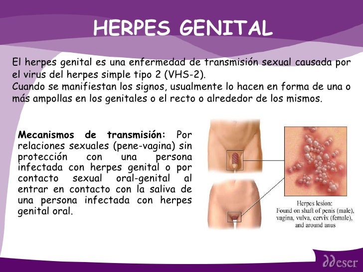 The First Genital Herpes Outbreak - What to Expect
