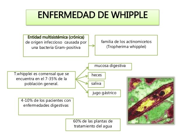 Enfermedad de whipple