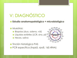 V: DIAGNÓSTICO
 Estudio anatomopatológico + microbiológico
 Muestras:
 Biopsias (duo, adeno, vál)
 Líquidos estériles (LCR, sino, pl)
 Heces, saliva
 Tinción histológica PAS
 PCR específica (hsp65, rpoß, 16S rRNA)
 