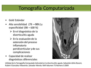 Tomografía Computarizada
• Gold Estándar
• Alta sensibilidad (79 —98%)y
especificidad (98 —100 %)
 En el diagnóstico de la
diverticulitis aguda
 En la evaluación de la
extensión del proceso
inflamatorio
peridiverticular yde sus
complicaciones
• Capacidad de realizar
diagnósticos diferenciales
Utilidad de la Tomografía Computada helicoidal enla diverticulitis aguda. Sebastián Atilio Rossini,
Rubén F.González Villaveirán, Salvador Merola. RAR Volumen 73 Número 32009
 