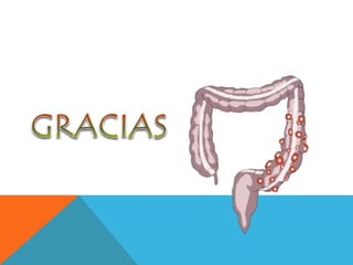 Enfermedad Diverticular