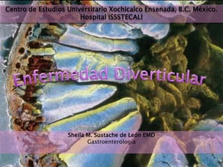 Centro de Estudios Universitario Xochicalco Ensenada, B.C, México.
Hospital ISSSTECALI
Sheila M. Sustache de León EMD
Gastroenterología
 