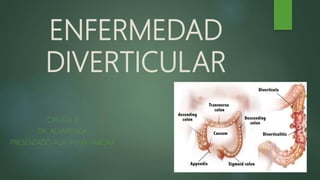 ENFERMEDAD
DIVERTICULAR
CIRUGIA II
DR. ALVARENGA
PRESENTADO POR: FENIX TABORA
 