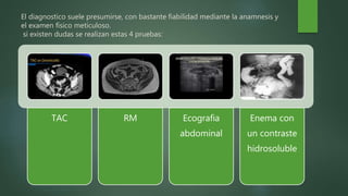 El diagnostico suele presumirse, con bastante fiabilidad mediante la anamnesis y
el examen físico meticuloso.
si existen dudas se realizan estas 4 pruebas:
TAC RM Ecografia
abdominal
Enema con
un contraste
hidrosoluble
 